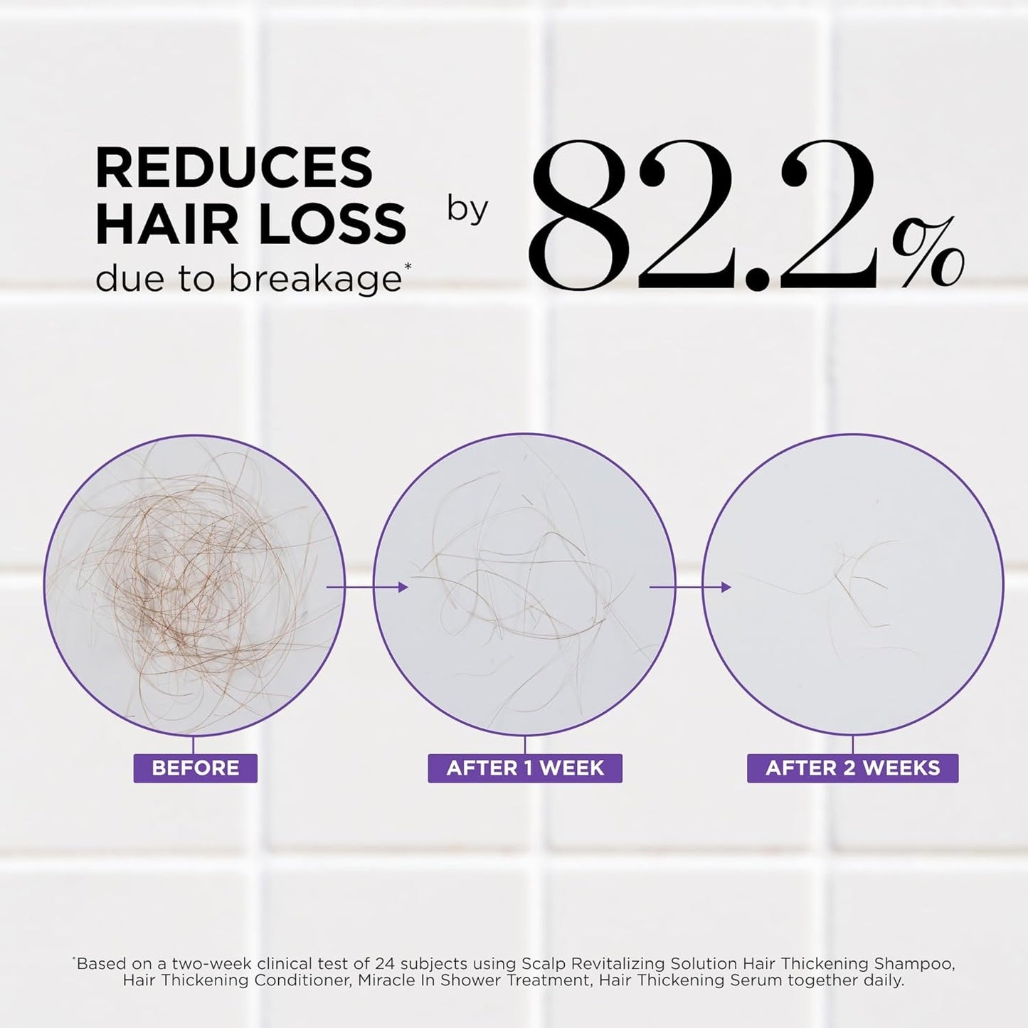 Dr. Groot Thickening Serum, Shampoo, Conditioner, and Scalp Treatment Set for Hair Loss – Clinical Results with Biotin and Rosemary for Hair Thinning, Shedding, Scalp Repair and Treatment