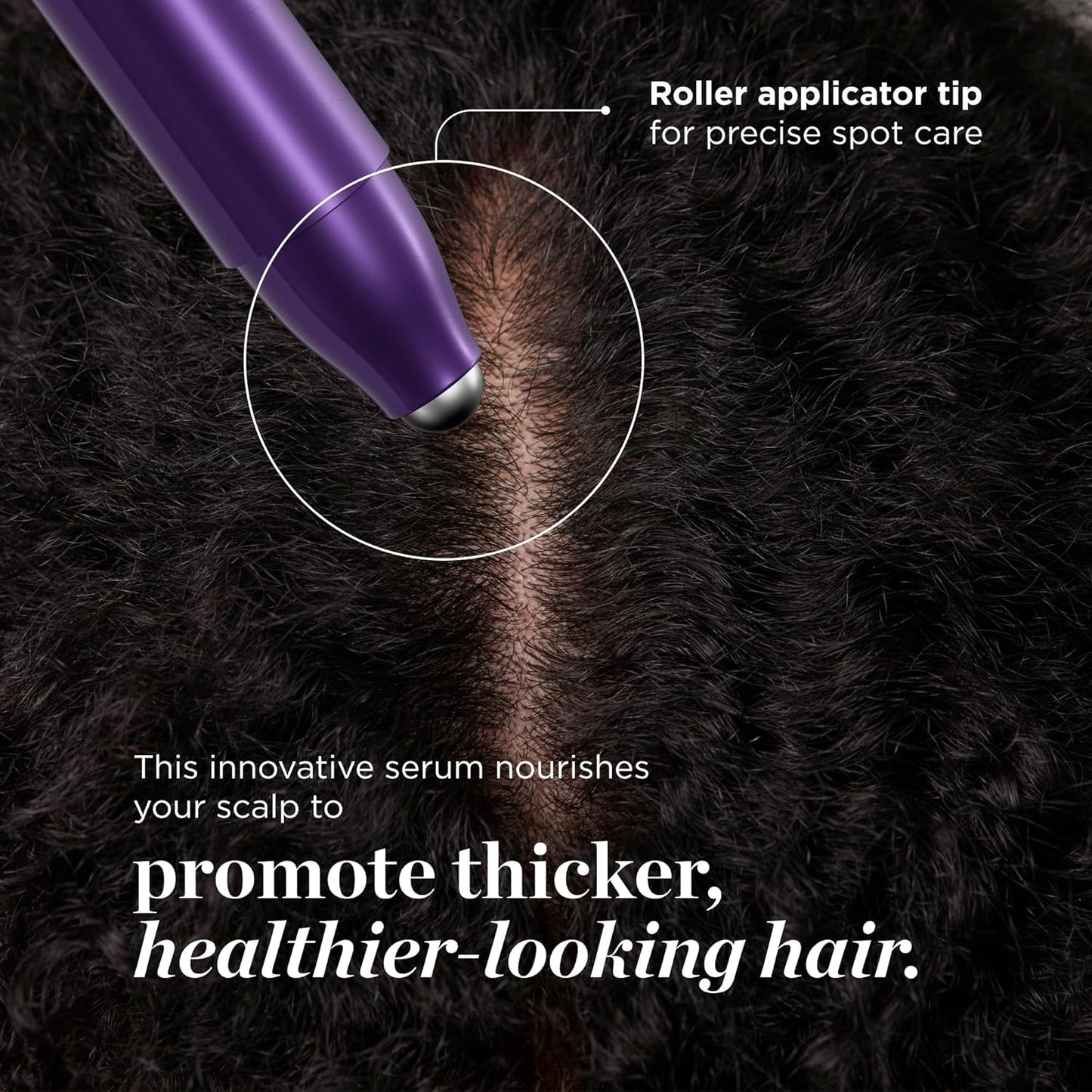 Award-Winning Hair Thickening Serum for Hair Loss, Thinning Hair, Korean Hair Care, Scalp Treatment, Clinically Tested, Thicker, Reduces Oil, Roll On